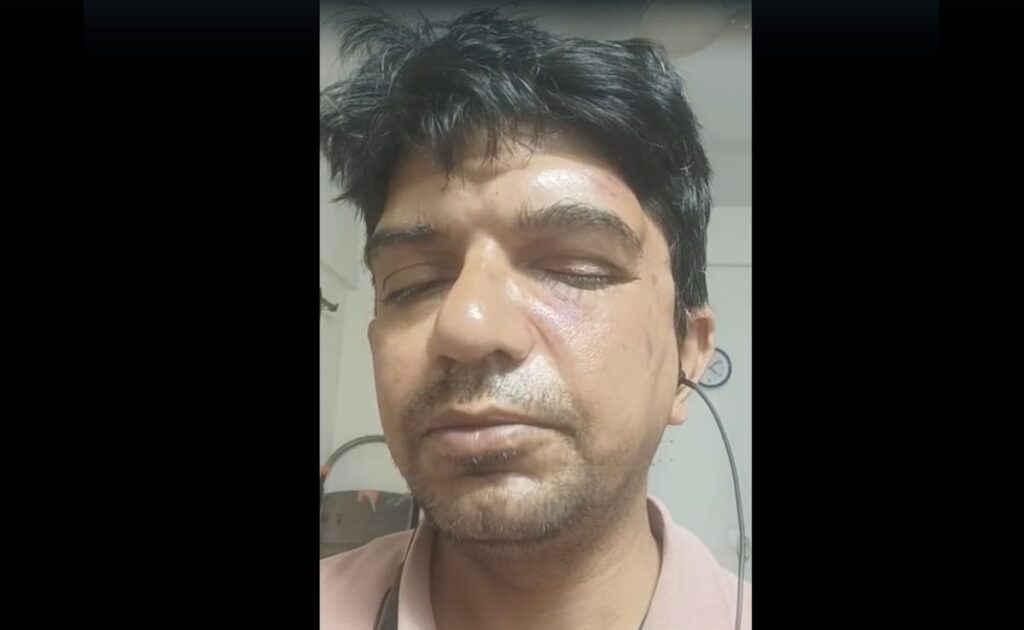 बेंगलुरु के प्रोफेसर ने पुरुषों को कचरा फेंकने से रोकने के लिए माना जाता है