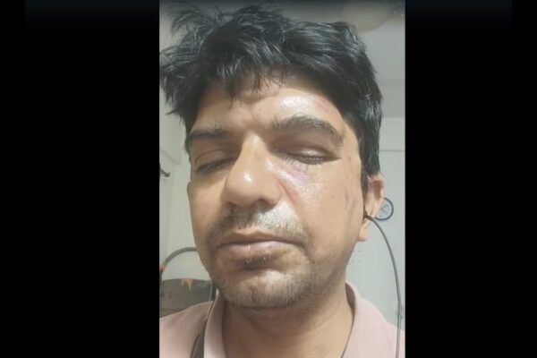 बेंगलुरु के प्रोफेसर ने पुरुषों को कचरा फेंकने से रोकने के लिए माना जाता है