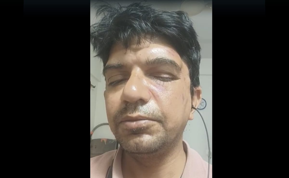 बेंगलुरु के प्रोफेसर ने पुरुषों को कचरा फेंकने से रोकने के लिए माना जाता है