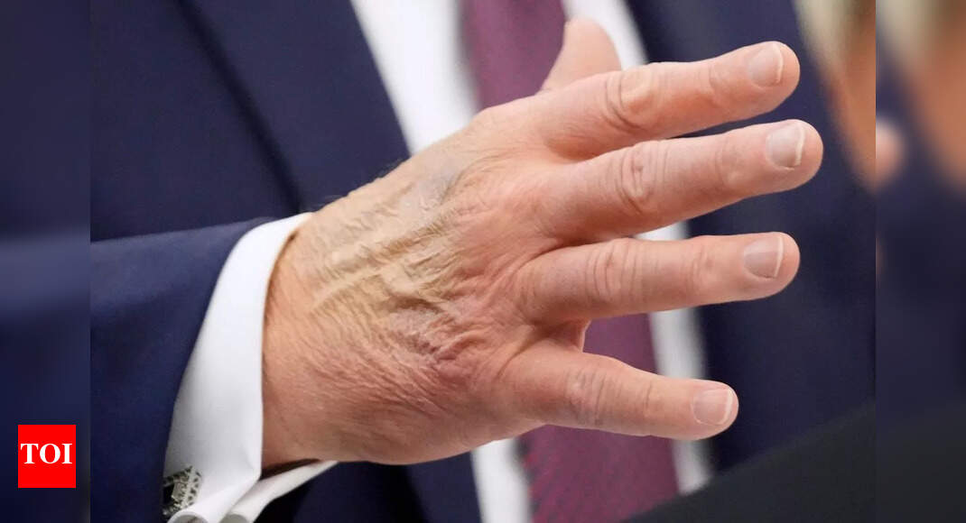 ट्रम्प ने स्वास्थ्य अफवाहों जैसे ‘झूठी समाचार’ पर शासन किया, लेकिन ‘दो टन के हाथ’ और देर से आगमन फिर से अंडाकार कार्यालय गपशप में है