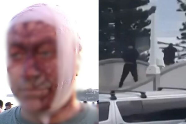 एक व्यक्ति जो 7 अक्टूबर को हमास के हमले में बच गया और बौंडी बीच पर हुई गोलीबारी में घायल हो गया, उसका कहना है कि “उसने कभी नहीं सोचा था कि वह ऑस्ट्रेलिया में ऐसा देखेगा”