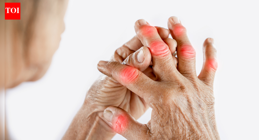 आयुर्वेद के माध्यम से गठिया और गठिया का सफलतापूर्वक प्रबंधन का एक केस अध्ययन