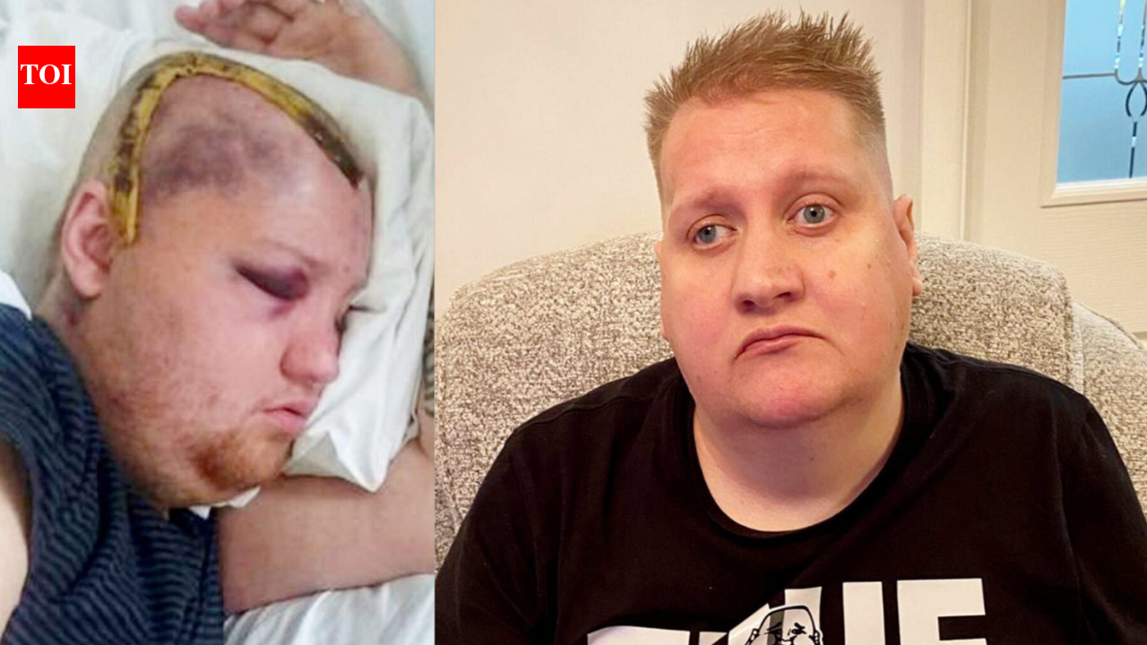 ‘यह एक बुरा सपना है’: ब्रिटेन के व्यक्ति ने छह महीने के बजाय आठ साल की कीमोथेरेपी प्राप्त करने के बाद एनएचएस पर मुकदमा दायर किया |