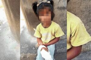 ‘उन्होंने उसके हाथ पर दरवाजा पटक दिया’: कर्नाटक के सरकारी स्कूल में 6 साल की बच्ची की दो उंगलियां कट गईं; शिक्षक उसे जल्दी से अस्पताल नहीं ले गए और कटे हुए हिस्सों को कूड़े में फेंक दिया गया | बेंगलुरु समाचार