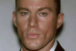 चैनिंग टैटम ने सर्जरी के बाद स्वास्थ्य अपडेट साझा किया: ‘मुझे वैसे भी निशान पसंद हैं’ |