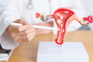 निराशा से उपचार तक: एक 61 वर्षीय महिला की डिम्बग्रंथि कैंसर से उबरने की यात्रा