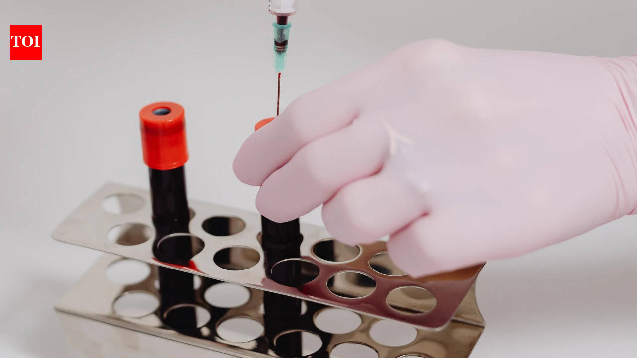 सरकार ने प्लाज्मा-आधारित दवाओं पर बार-बार होने वाले वायरस परीक्षण को खत्म करने का प्रस्ताव रखा है | भारत समाचार